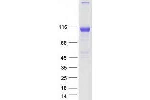 Validation with Western Blot (EPH Receptor A7 Protein (EPHA7) (Myc-DYKDDDDK Tag))