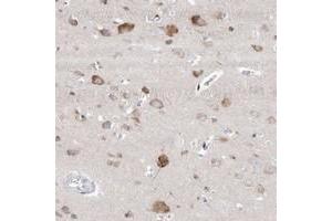 Immunohistochemical staining of human cerebral cortex with GABRG1 polyclonal antibody  shows moderate cytoplasmic positivity in neuronal cells at 1:20-1:50 dilution. (GABRg1 antibody)