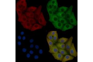 c-Met Mouse Monoclonal Antibody staining Hela cells by IF/ICC.