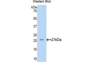 Western blot analysis of the recombinant protein. (Neuropilin 1 antibody  (AA 646-814))