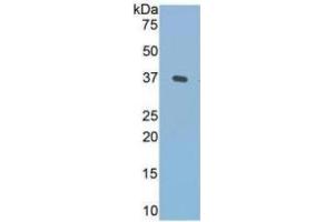 Western Blotting (WB) image for Fibronectin ELISA Kit (ABIN6574104)