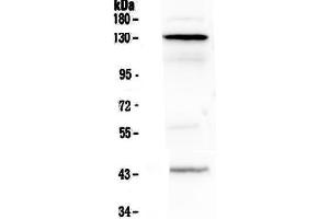 Western blot analysis of VE Cadherin using anti-VE Cadherin antibody . (Cadherin 5 antibody  (AA 48-272))