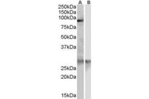 Image no. 1 for anti-Acetyl LDL Receptor (SCARF1) (Internal Region) antibody (ABIN374467) (SCARF1 antibody  (Internal Region))