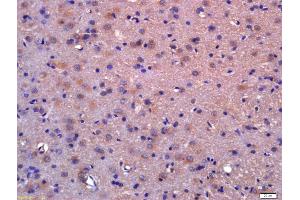 Formalin-fixed and paraffin embedded rat brain labeled with Anti-LDOC1/BCUR1 Polyclonal Antibody, Unconjugated (ABIN717836) at 1:200 followed by conjugation to the secondary antibody and DAB staining