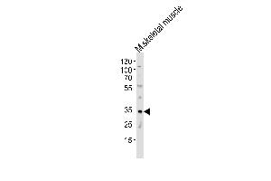 MOGAT2 antibody  (C-Term)