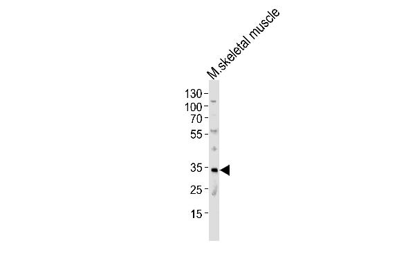 MOGAT2 antibody  (C-Term)