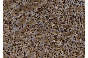 ABIN6279817 at 1/100 staining Human liver tissue by IHC-P. (SH3BGRL antibody  (Internal Region))