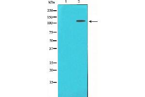 Western blot analysis of CD130/gp130 expression in Jurkat whole cell lysates,The lane on the left is treated with the antigen-specific peptide. (CD130/gp130 antibody  (C-Term))