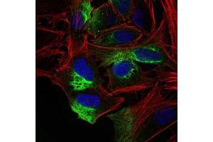 Immunofluorescence analysis of Hela cells using ZEB1 mouse mAb (green). (ZEB1 antibody  (AA 967-1108))