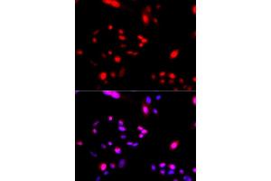 Immunofluorescence (IF) image for anti-Cullin 4A (CUL4A) antibody (ABIN6219875) (Cullin 4A antibody)