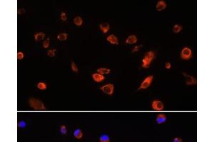 Immunofluorescence analysis of L929 cells using ARL13B Polyclonal Antibody at dilution of 1:100. (ARL13B antibody)