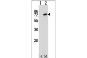 Western blot analysis of Nek8 (arrow) using rabbit polyclonal Mouse Nek8 Antibody (C-term) (ABIN657848 and ABIN2846809).