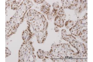 Immunoperoxidase of monoclonal antibody to UBTF on formalin-fixed paraffin-embedded human placenta. (UBTF antibody  (AA 551-650))