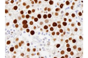 Immunohistochemistry (IHC) image for anti-Minichromosome Maintenance Complex Component 2 (MCM2) (pSer108) antibody (ABIN7448988)
