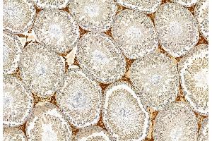 ABIN6265713 and ABIN6272897 at 1/100 staining Rat testis tissue by IHC-P. (TAGLN2 antibody  (Internal Region))