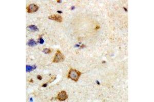 Immunohistochemical analysis of TRAF6 staining in human brain formalin fixed paraffin embedded tissue section. (TRAF6 antibody)