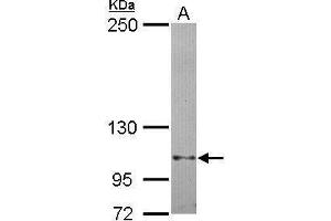 WB Image Sample (30 ug of whole cell lysate) A: Hela 5% SDS PAGE antibody diluted at 1:1000 (FAK antibody  (C-Term))