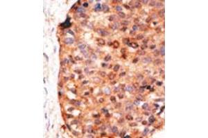 Image no. 2 for anti-Apolipoprotein B mRNA Editing Enzyme, Catalytic Polypeptide-Like 3G (APOBEC3G) (C-Term) antibody (ABIN356860) (APOBEC3G antibody  (C-Term))