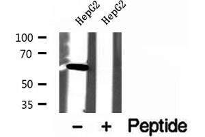 Western blot analysis of extracts of HepG2 cells, using USP39 antibody.