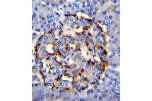 Immunohistochemistry (IHC) image for anti-Phospholipase A2, Group IID (PLA2G2D) antibody (ABIN2996055) (PLA2G2D antibody)