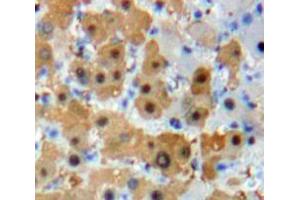Used in DAB staining on fromalin fixed paraffin-embedded Liver tissue (FOXO1 antibody  (AA 222-469))