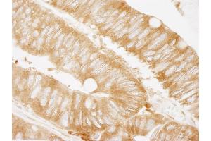 Immunohistochemistry (IHC) image for anti-Lysyl-tRNA Synthetase (KARS) (C-Term) antibody (ABIN7448981)