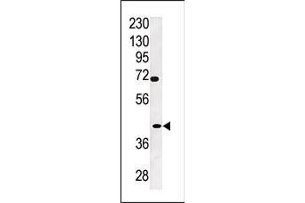 TPST2 antibody  (C-Term)