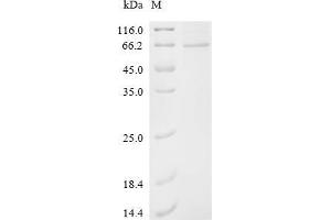 (Tris-Glycine gel) Discontinuous SDS-PAGE (reduced) with 5 % enrichment gel and 15 % separation gel.