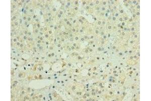 Immunohistochemistry of paraffin-embedded human adrenal gland tissue using ABIN7155978 at dilution of 1:100 (HYLS1 antibody  (AA 70-299))