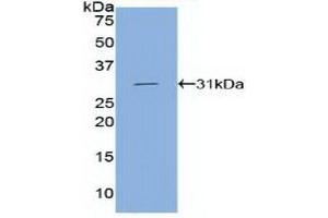 Western blot analysis of recombinant Human CDH5. (Cadherin 5 antibody  (AA 68-307))