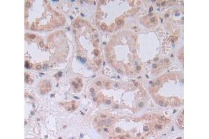 Used in DAB staining on fromalin fixed paraffin- embedded Kidney tissue (UMPS antibody  (AA 205-480))