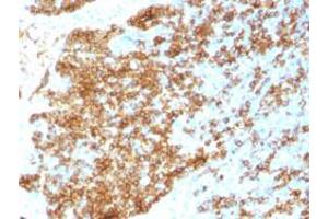 Immunohistochemical staining (Formalin-fixed paraffin-embedded sections) of human tonsil with CD45RB recombinant monoclonal antibody, clone PTPRC/1783R .