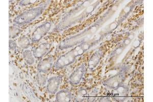 Immunostaining (ISt) image for anti-Hematopoietic Cell-Specific Lyn Substrate 1 (HCLS1) (AA 266-355) antibody (ABIN516375)
