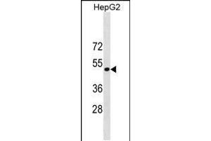 Western blot analysis in HepG2 cell line lysates (35ug/lane). (ST6GAL1 antibody  (AA 178-206))