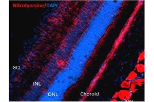 Immunohistochemistry analysis using Mouse Anti-Nitrotyrosine Monoclonal Antibody, Clone 39B6 . (Nitrotyrosine antibody  (Atto 390))