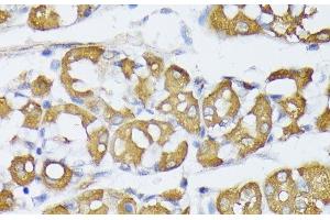 Immunohistochemistry of paraffin-embedded Human stomach using VAPA Polyclonal Antibody at dilution of 1:100 (40x lens). (VAPA antibody)