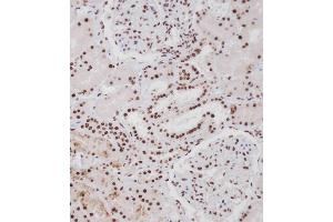 Immunohistochemical analysis of A on paraffin-embedded Human kidney tissue. (ERBB4 antibody  (pTyr1188))