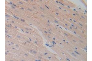 Immunohistochemistry (IHC) image for anti-Hexosaminidase B (Beta Polypeptide) (HEXB) (AA 294-435) antibody (ABIN7438139)