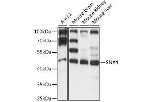 Western blot analysis of extracts of various cell lines, using SNX4 antibody (ABIN6291214) at 1:1000 dilution.