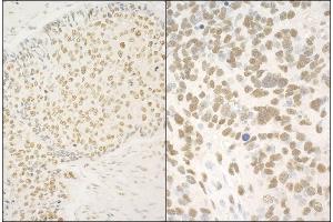 anti-Glucocorticoid Modulatory Element Binding Protein 1 (GMEB1) (AA 523-573) antibody