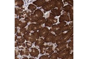 Immunohistochemical staining of human stomach with RPS4Y1 polyclonal antibody  shows strong cytoplasmic positivity in glandular cells at 1:50-1:200 dilution.