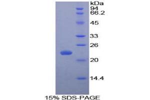 SDS-PAGE (SDS) image for Interleukin 1 Receptor Antagonist (IL1RN) protein (ABIN3010127)