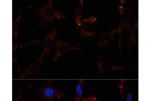 Immunofluorescence analysis of NIH/3T3 cells using RALA Polyclonal Antibody at dilution of 1:100. (rala antibody)