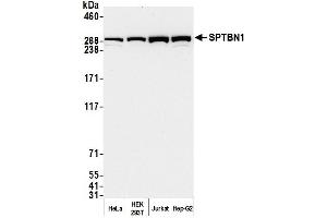 Western Blotting (WB) image for anti-Spectrin Beta, Non-Erythrocytic 1 (SPTBN1) (AA 2100-2150) antibody (ABIN7454694)