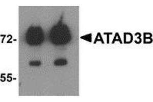 Western blot analysis of ATAD3B in human kidney tissue lysate with ATAD3B antibody at (left) 1 and (right) 2 μg/ml (ATAD3B antibody  (C-Term))