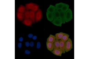 ABIN6266359 and ABIN6276704 staining Hela cells(30 min of UV treatment) by IF/ICC.