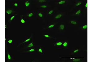 Immunofluorescence of purified MaxPab antibody to ESRRA on HeLa cell. (ESRRA antibody  (AA 1-423))