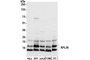 anti-Ribosomal Protein L36 (RPL36) (AA 55-105) antibody