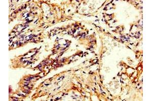 Immunohistochemistry of paraffin-embedded human lung tissue using ABIN7146632 at dilution of 1:100 (PDE4B antibody  (AA 27-215))