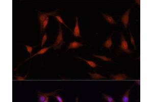 Immunofluorescence analysis of PC12 cells using FKBP5 Polyclonal Antibody at dilution of 1:100. (FKBP5 antibody)